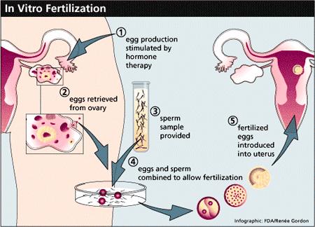 Let’s Understand In Vitro Fertilization